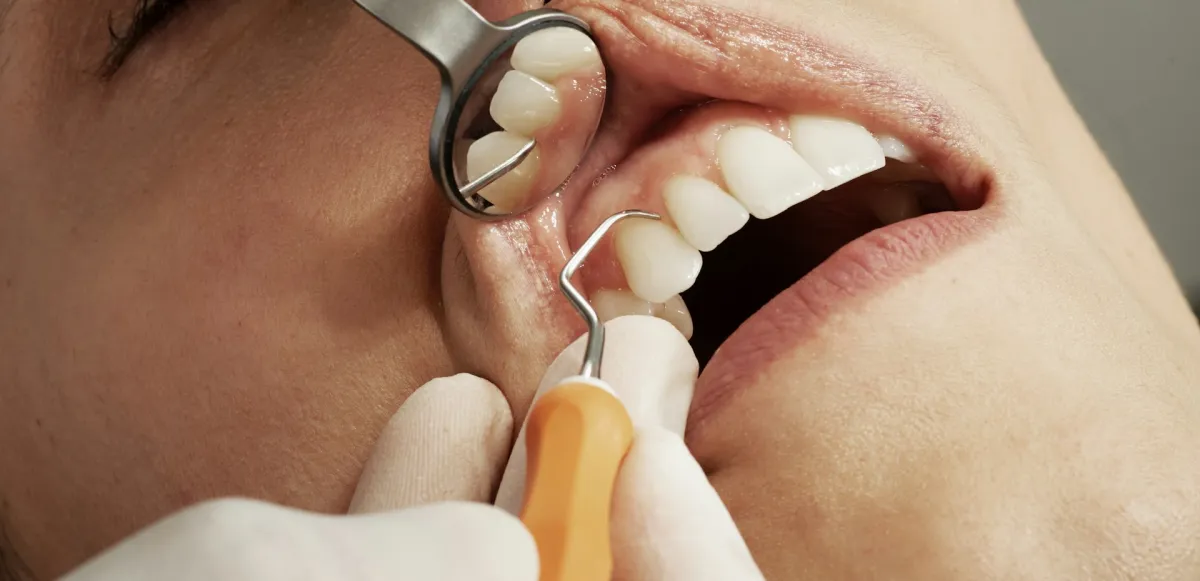 Conversación durante una visita al dentista