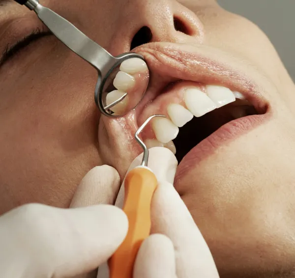 Conversación durante una visita al dentista